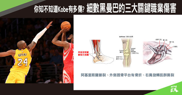 你知不知道Kobe有多傷?細數黑曼巴的三大關鍵職業傷害