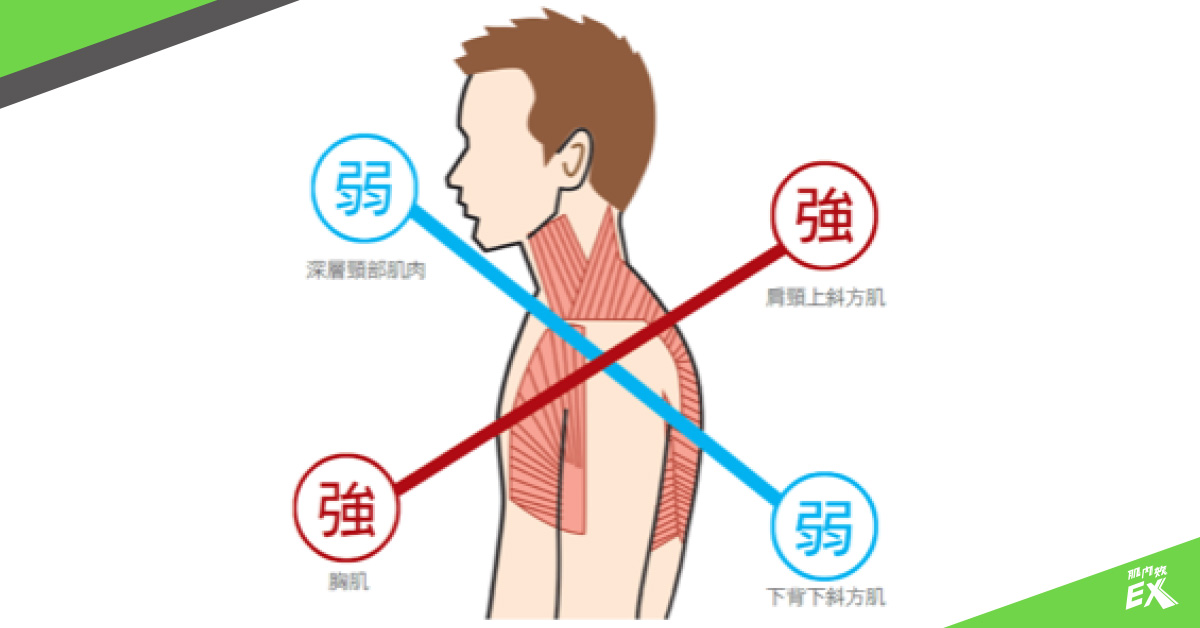 強化與伸展4招解決上交叉綜合症帶來的五大影響