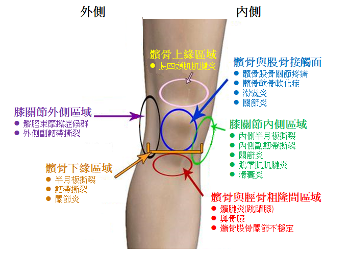 膝關節