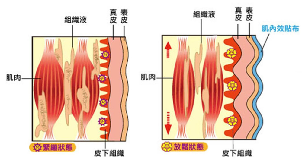 告別腿 踝 手 臉浮腫4大消腫貼法全部公開 肌內效ex 告別腿 踝 手 臉浮腫4大消腫貼法全部公開 肌內效ex